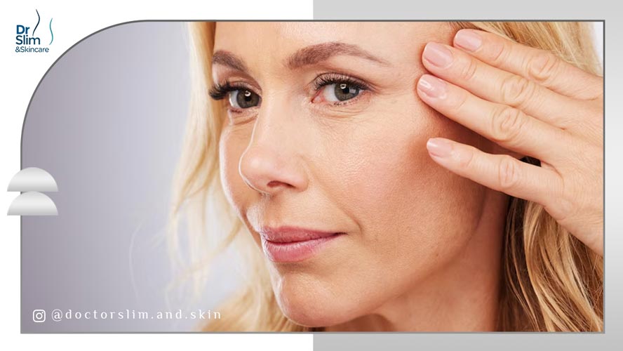 چین و چروک زیر چشم