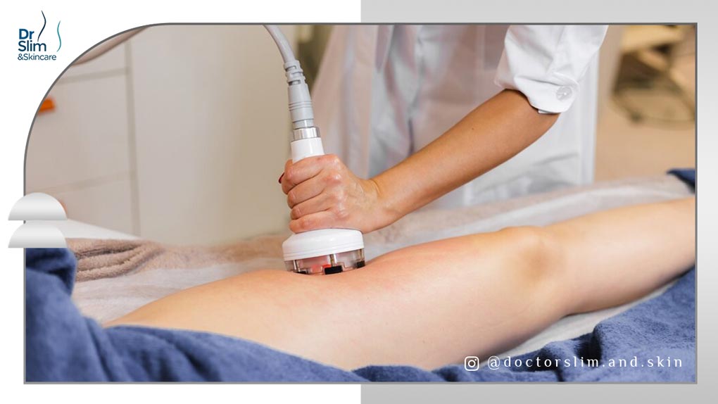 دستگاه کویتیشن چیست