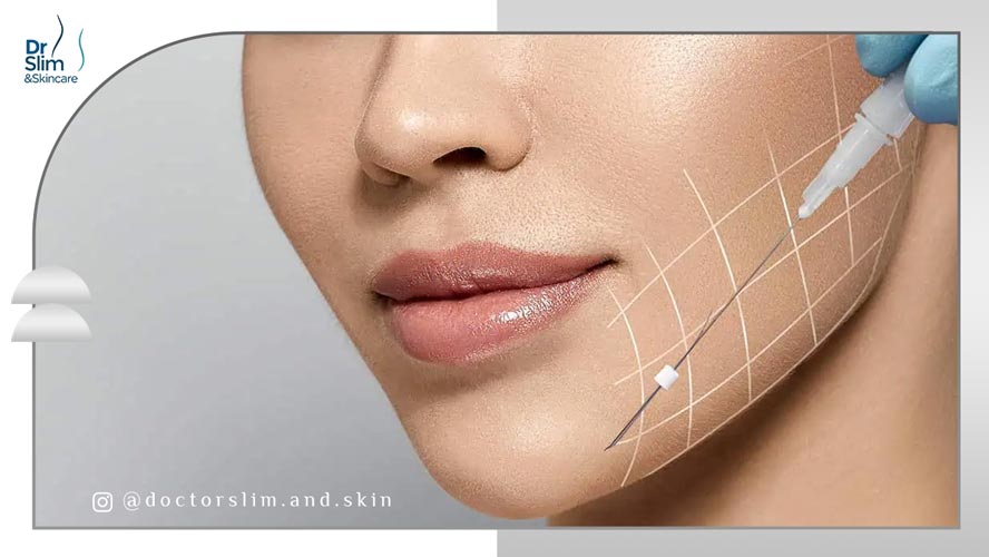 لیفت با نخ بهتر است یا هایفوتراپی