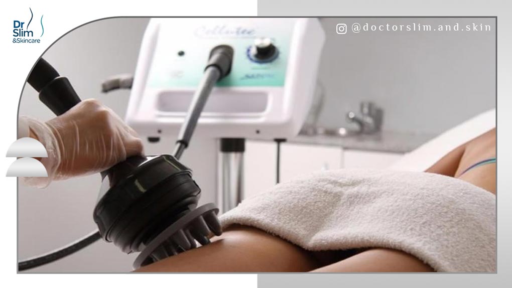 مقایسه دستگاه کول اسکالپتینگ و جی فایو