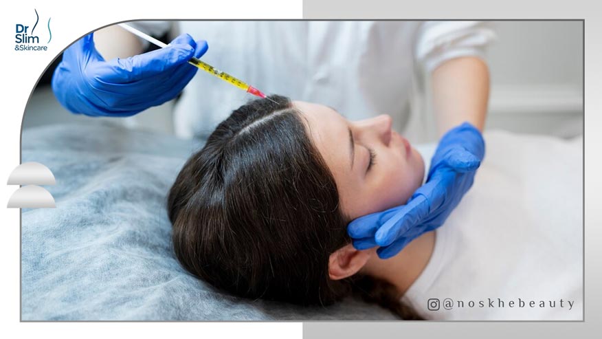 تفاوت پی آر پی و بایو فیلر