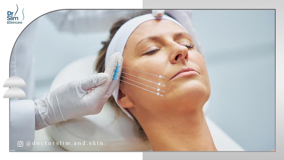 لیفت با نخ چیست