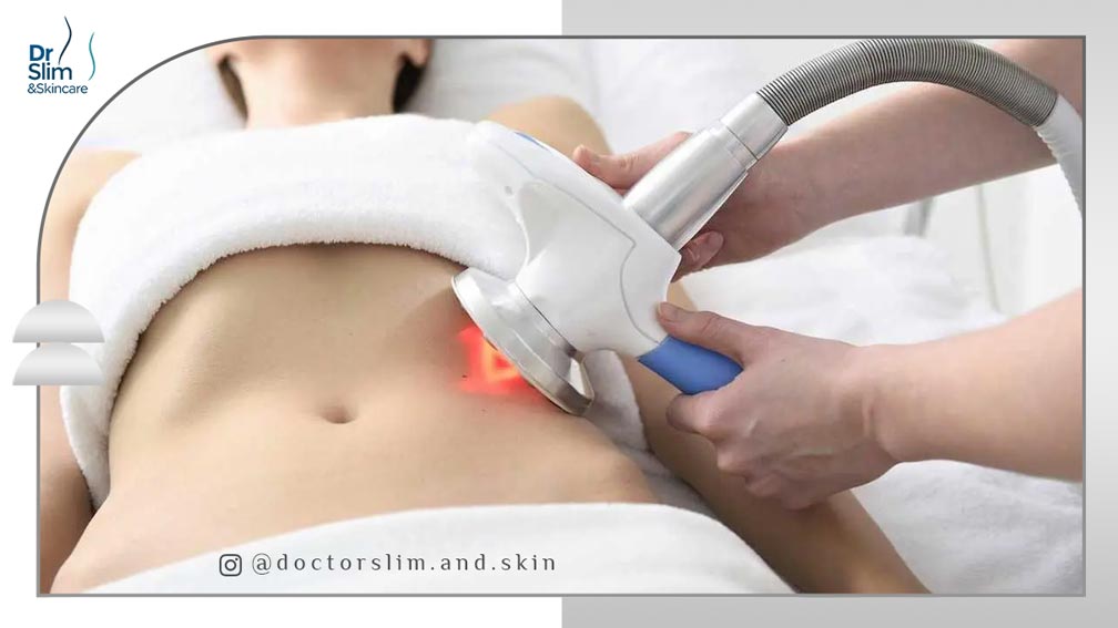 مقایسه دستگاه کول اسکالپتینگ و اگزیمیا