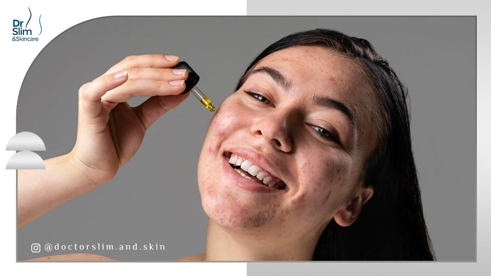 کمبود کدام ویتامین ‌ها باعث لک صورت می ‌شود