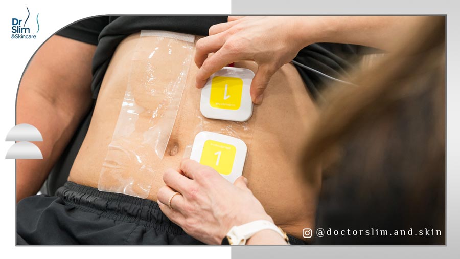 لاغری با ترواسکالپ معجزه لاغری بدون درد و دوره نقاهت