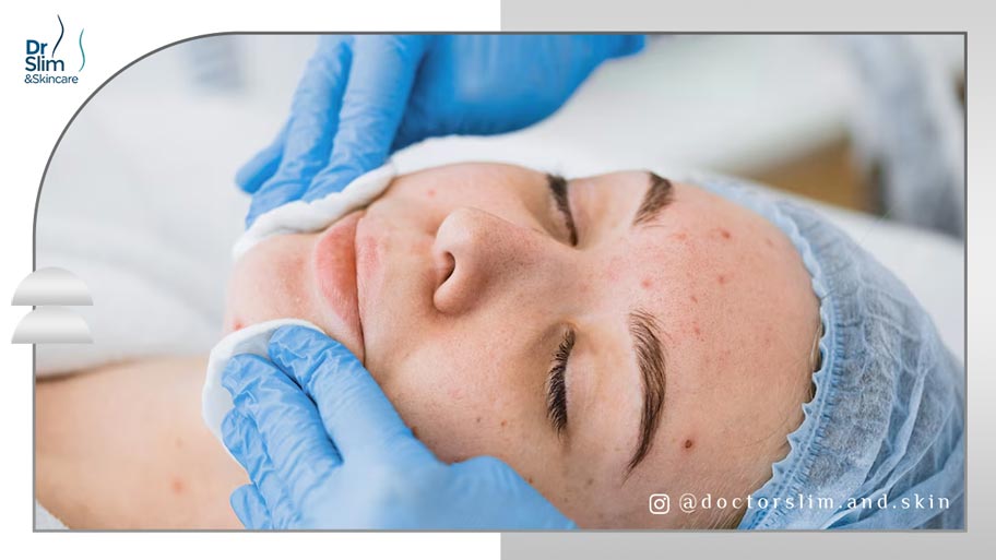 سریع ‌ترین راه برای از بین بردن لک صورت