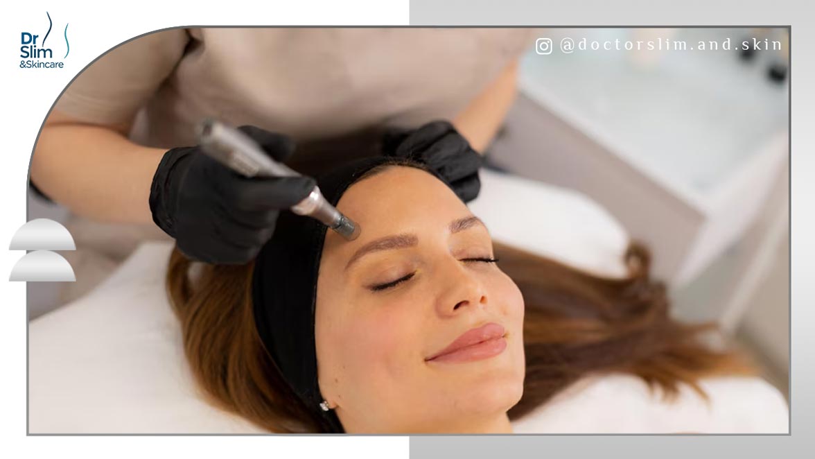 پلاژن تراپی بهتر است یا میکرونیدلینگ