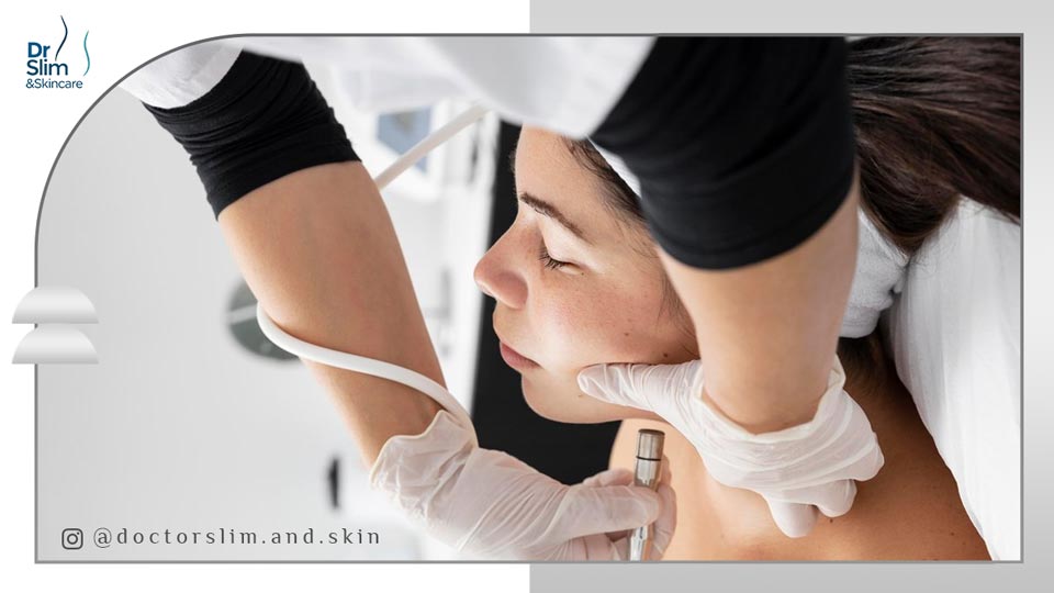 رفع غبغب با دستگاه آر اف بهترین و مؤثرترین روش