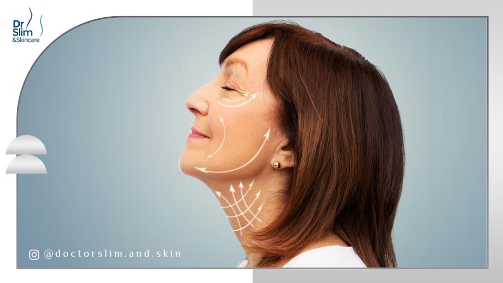 بهترین نخ لیفت صورت