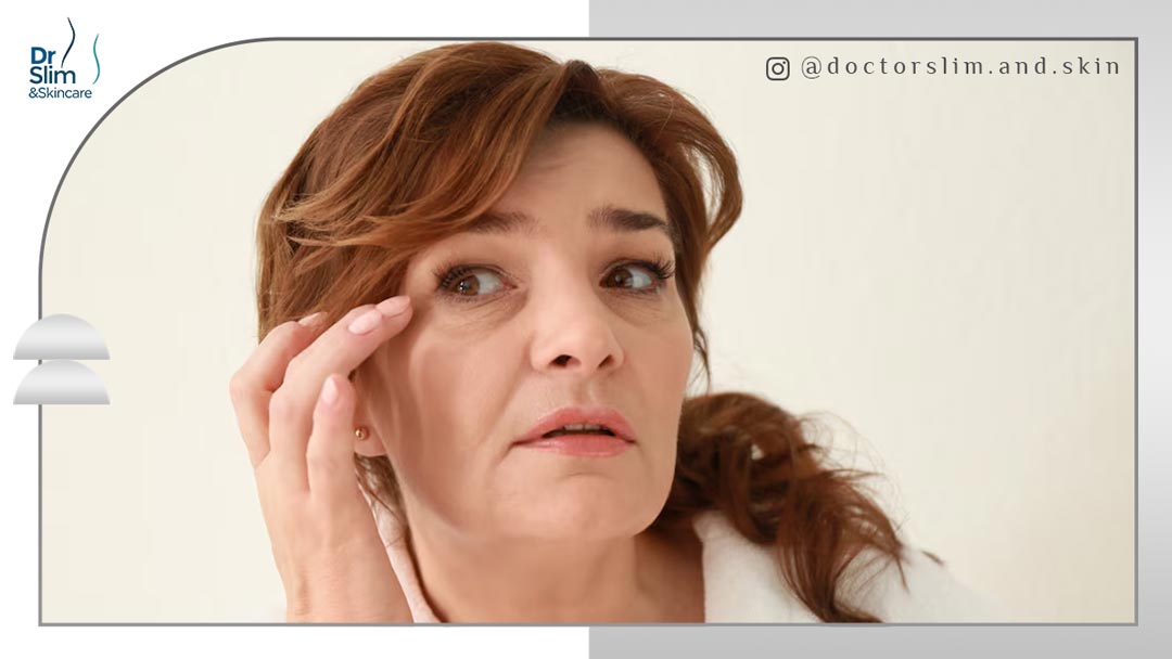 از بین بردن پف زیر چشم