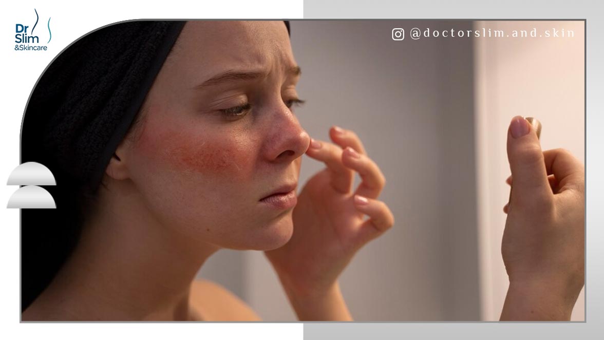 آنتی بیوتیک برای جوش زیر پوستی