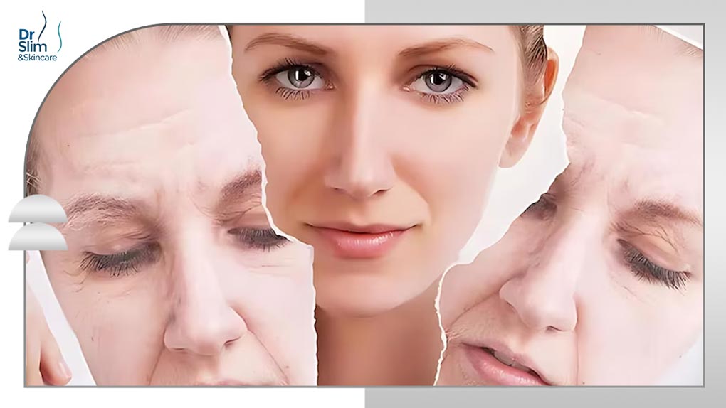 لیفتینگ و جوانسازی