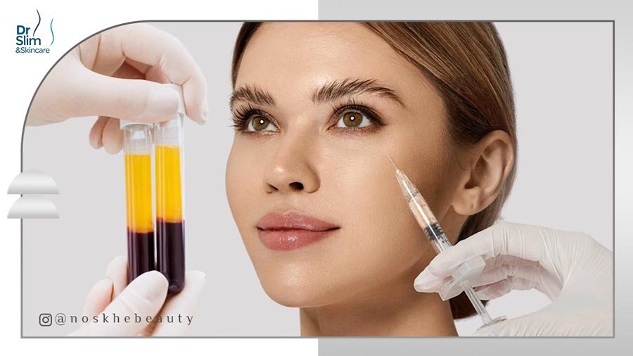 تفاوت پی آر پی و بایو فیلر