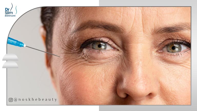 پی آر اف چیست