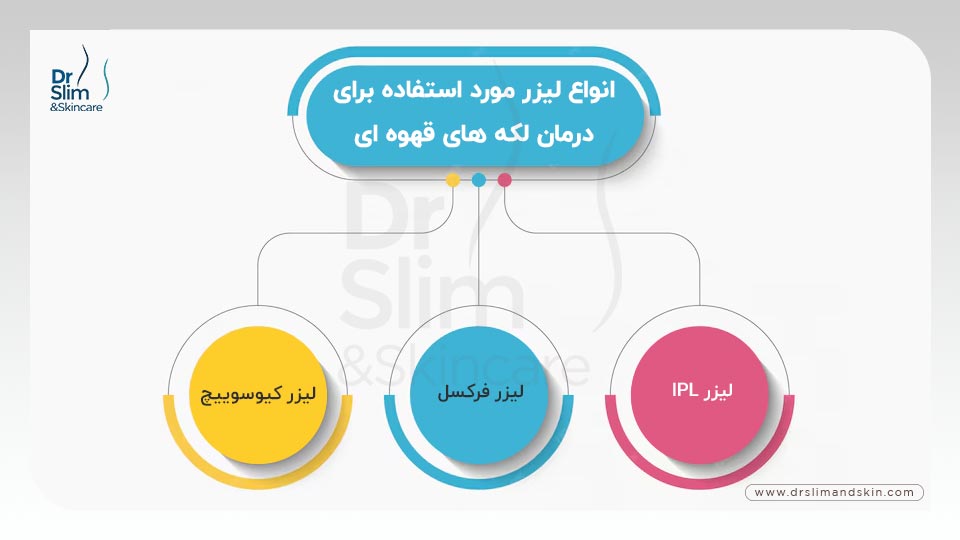 از بین بردن لکه های قهوه ای صورت با لیزر