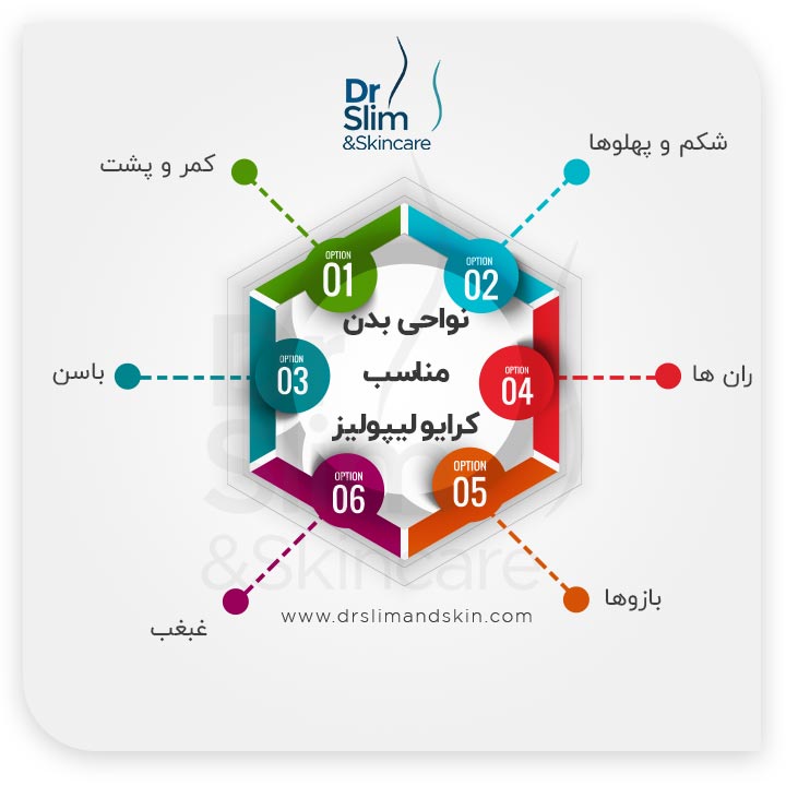 دستگاه لاغری کرایو لیپولیز