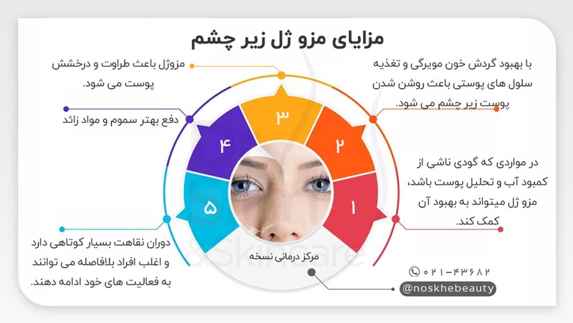 مزو ژل زیر چشم چیست