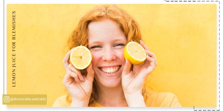 آب لیمو ترش برای لک صورت