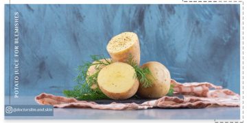 آب سیب زمینی برای لک صورت