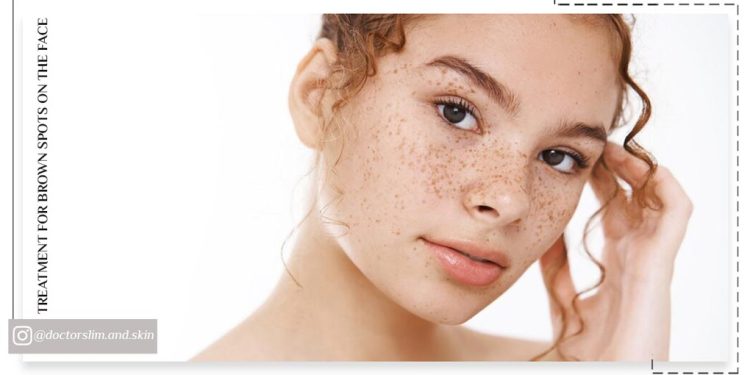 بهترین درمان لک قهوه ای صورت