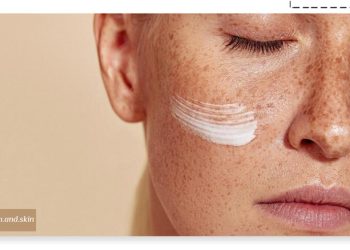 بهترین کرم برای لک قهوه‌ای صورت