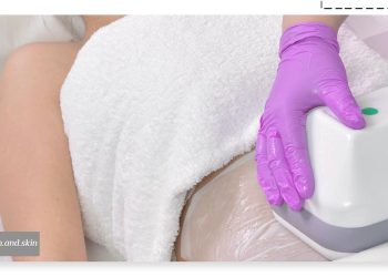 کاربرد کرایولیپولیز چیست