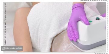 کاربرد کرایولیپولیز چیست