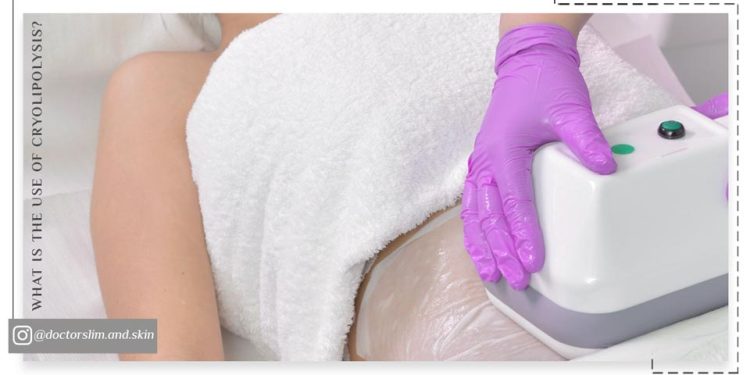 کاربرد کرایولیپولیز چیست