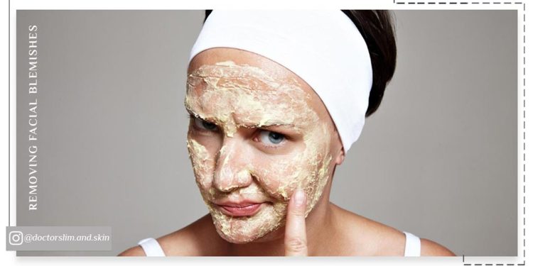 از بین بردن لک صورت با سیب زمینی و گلاب