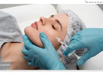 درمان لک صورت با مزوتراپی