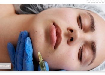 درمان لک ‌های صورت با مزوتراپی فیوژن