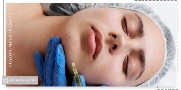درمان لک ‌های صورت با مزوتراپی فیوژن