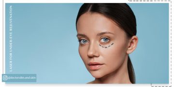 بهترین لیزر برای جوانسازی زیر چشم