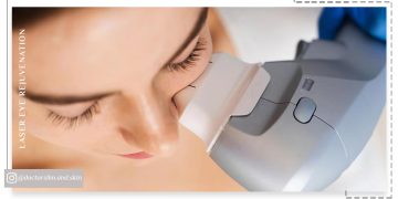 جوانسازی دور چشم با لیزر