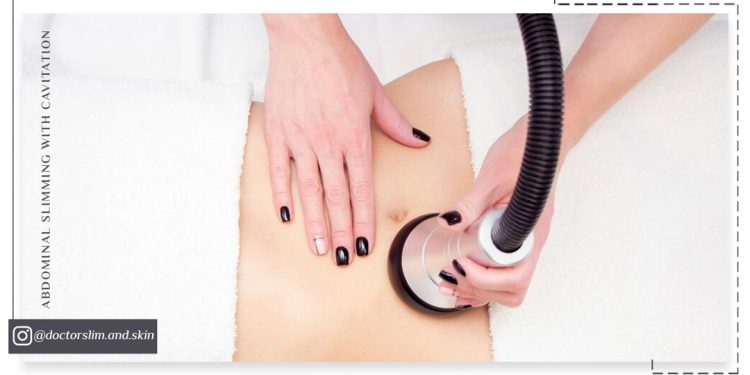 لاغری شکم با کویتیشن