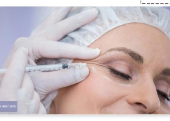 رفع تیرگی زیر چشم با مزوتراپی