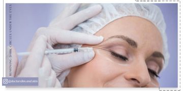 رفع تیرگی زیر چشم با مزوتراپی