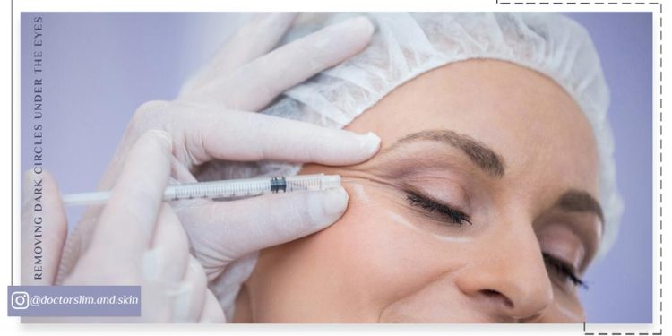 رفع تیرگی زیر چشم با مزوتراپی