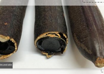 خواص فلوس برای لاغری