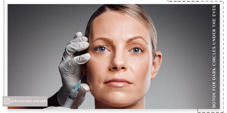 بوتاکس برای گودی زیر چشم