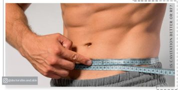 کویتیشن بهتر است یا آر اف