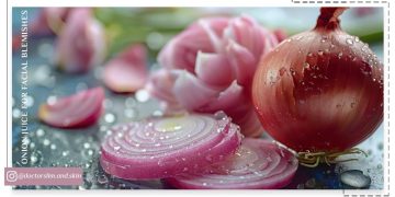 آب پیاز برای لک صورت