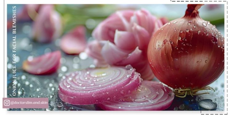 آب پیاز برای لک صورت