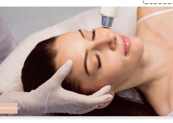 از بین بردن لک صورت با لیزر