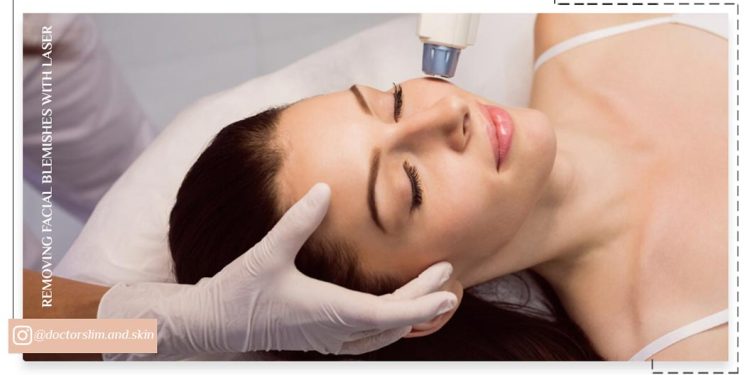 از بین بردن لک صورت با لیزر