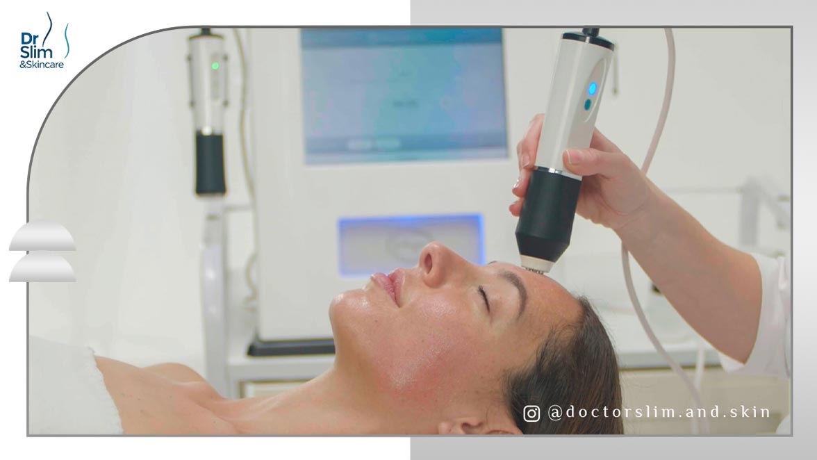 رفع خطوط اخم با پلاژن‌ تراپی