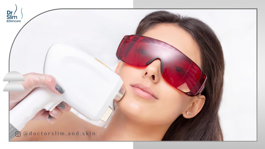 بهترین لیزر برای هایپرپیگمنتیشن صورت