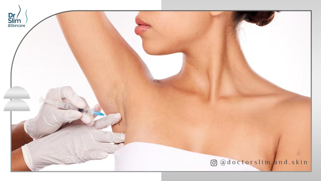 رفع بوی بد زیر بغل با بوتاکس