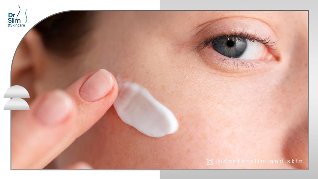 بهترین کرم برای لک قهوهای صورت