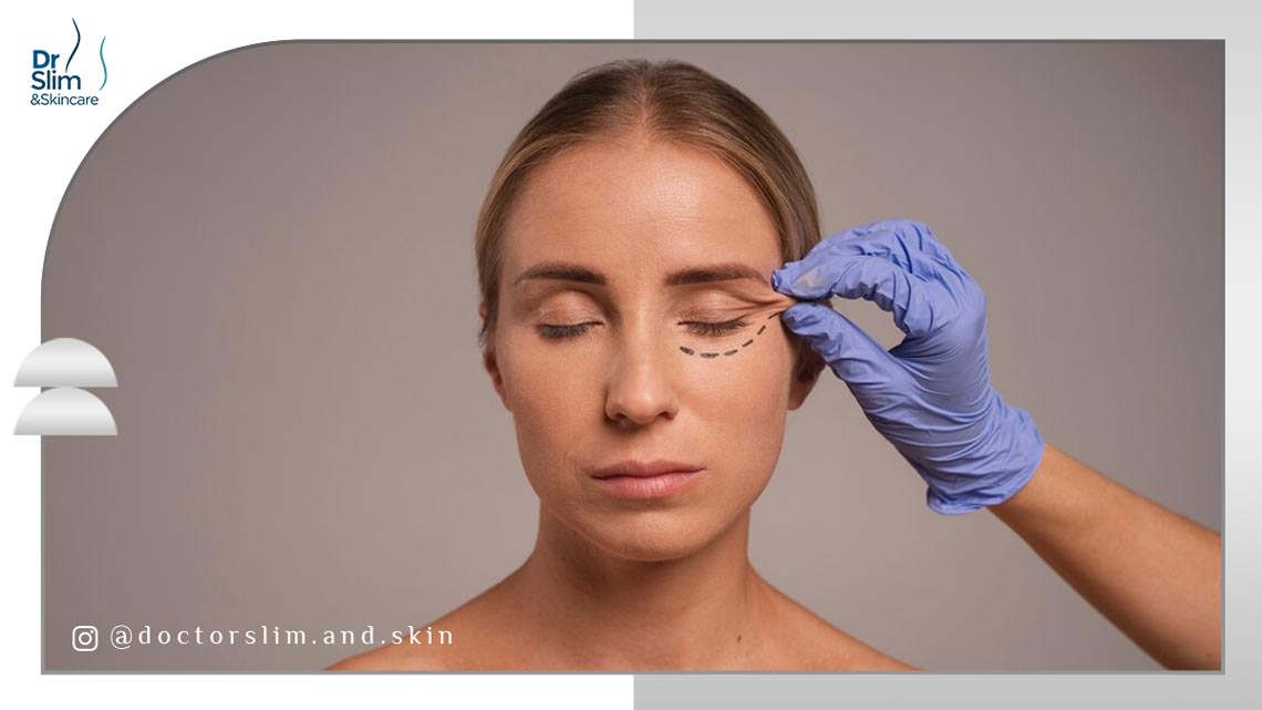 دستگاه ترماژ برای جوانسازی زیر چشم